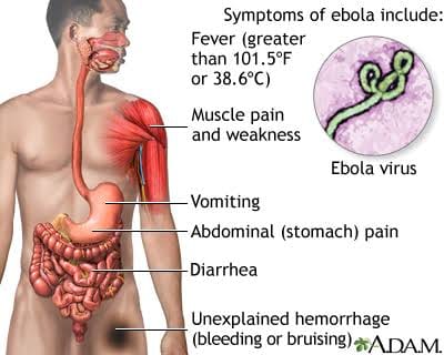 Ebola funding: Senate’s ₦10bn request tests Nigeria’s health preparedness and accountability
